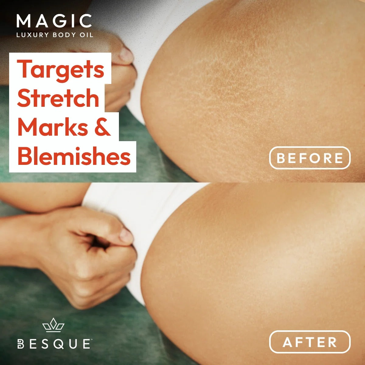 Besque Original Magic Body Oil – Hydrating Body Oil for Women, 3.4 Fl Oz / 100.55 mL